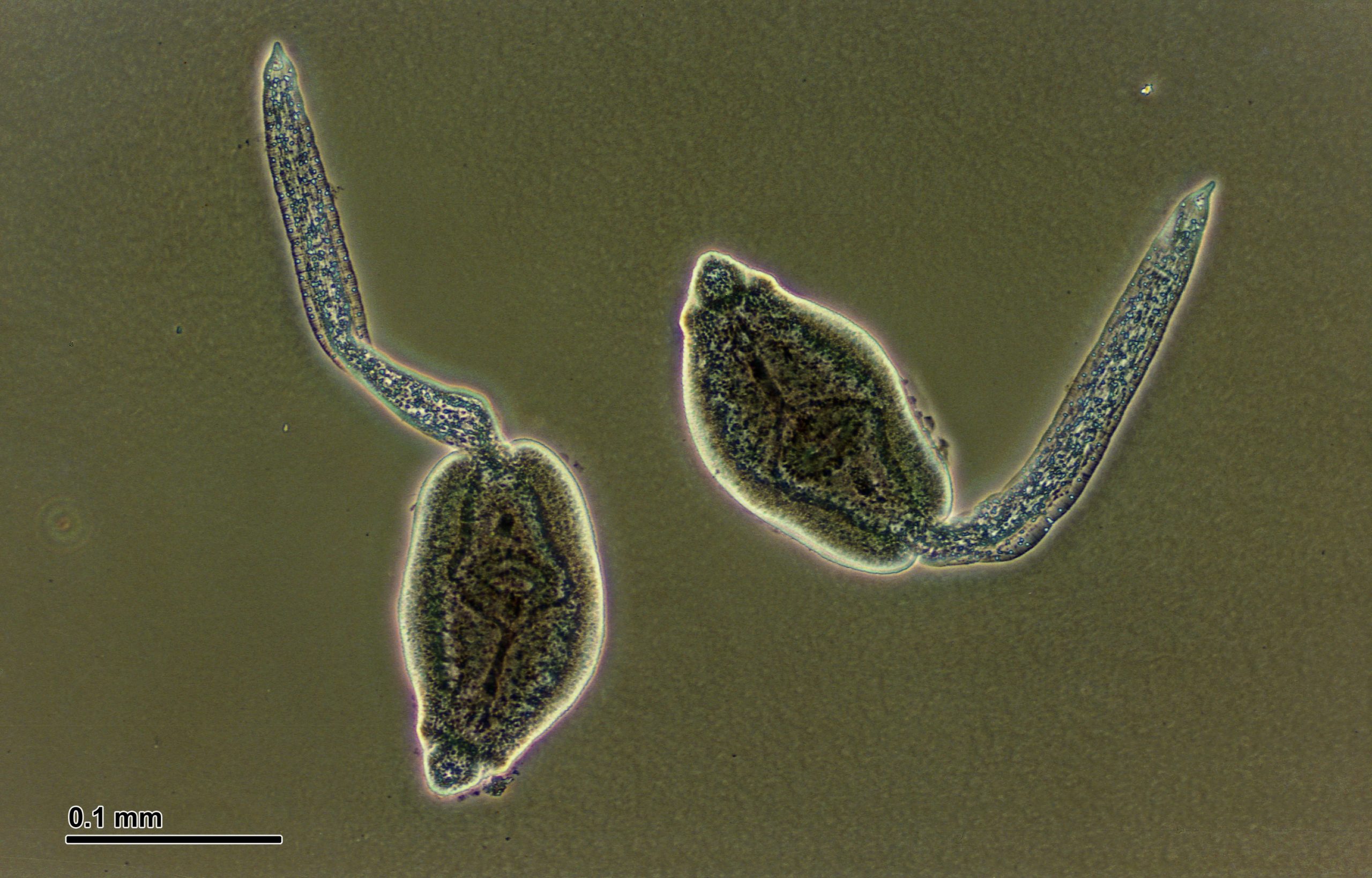 Церкариоз: как избежать «болезни купальщиков»?