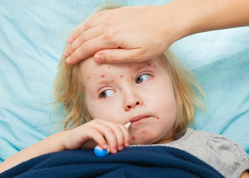 Как защититься от кори