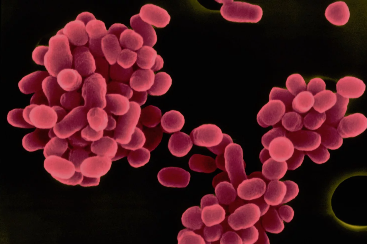 Профилактика бруцеллеза