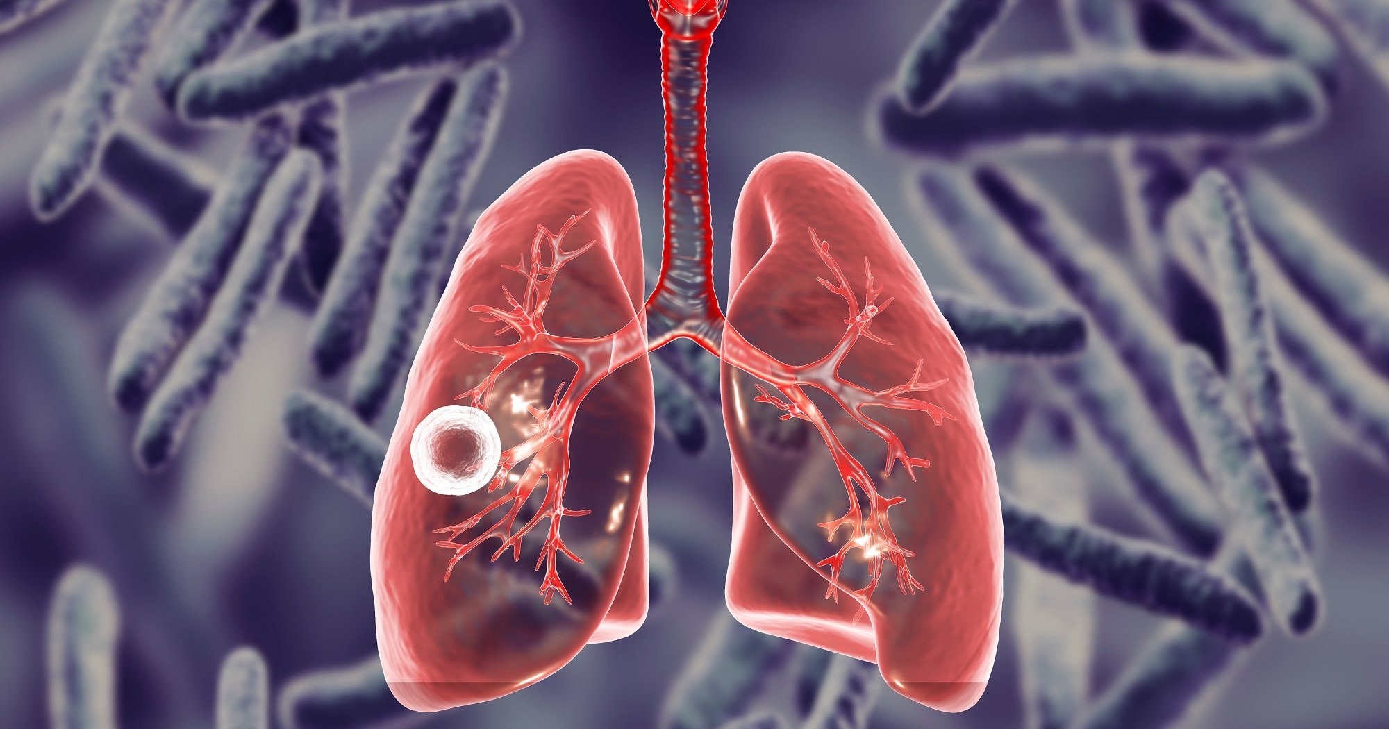 Туберкулез