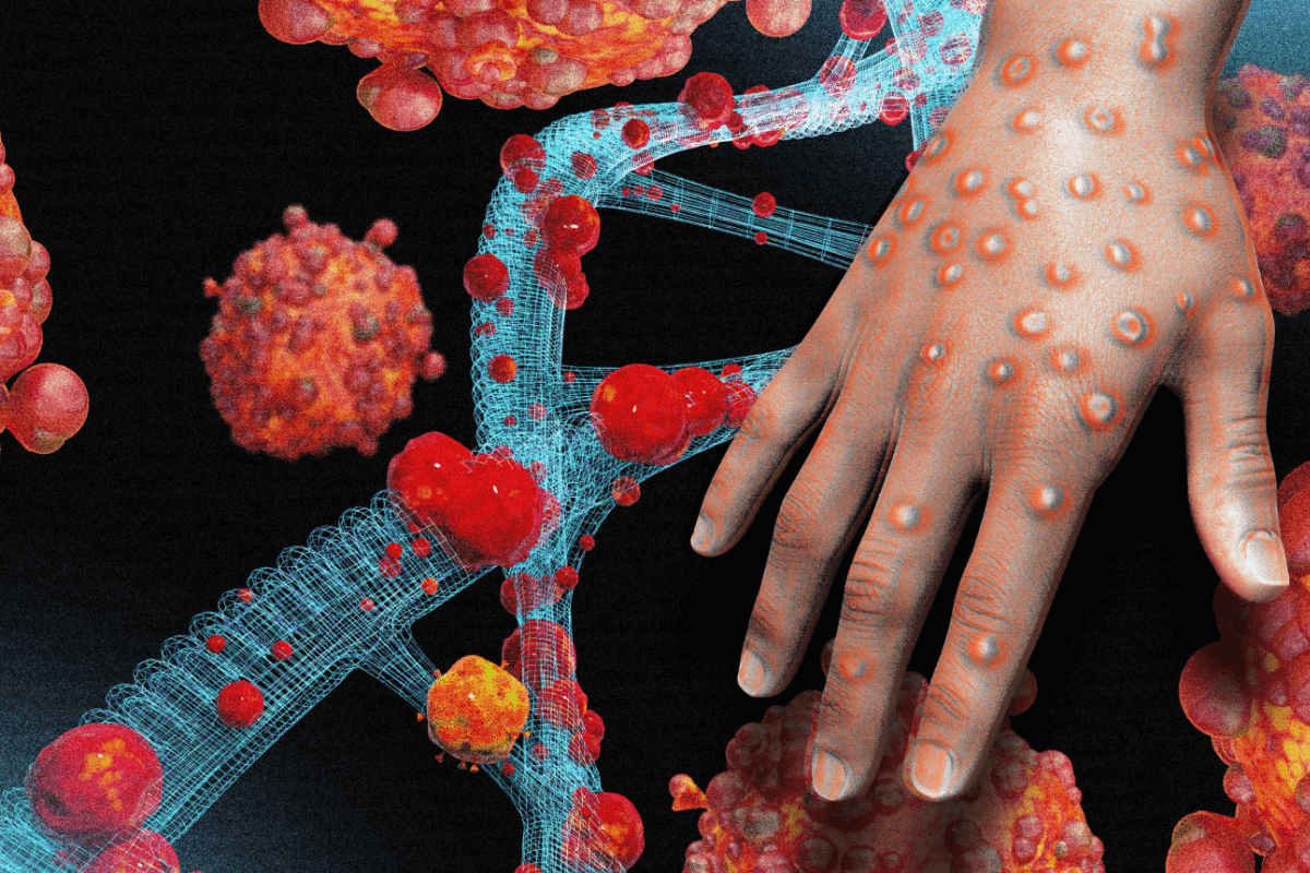 Оспа обезьян