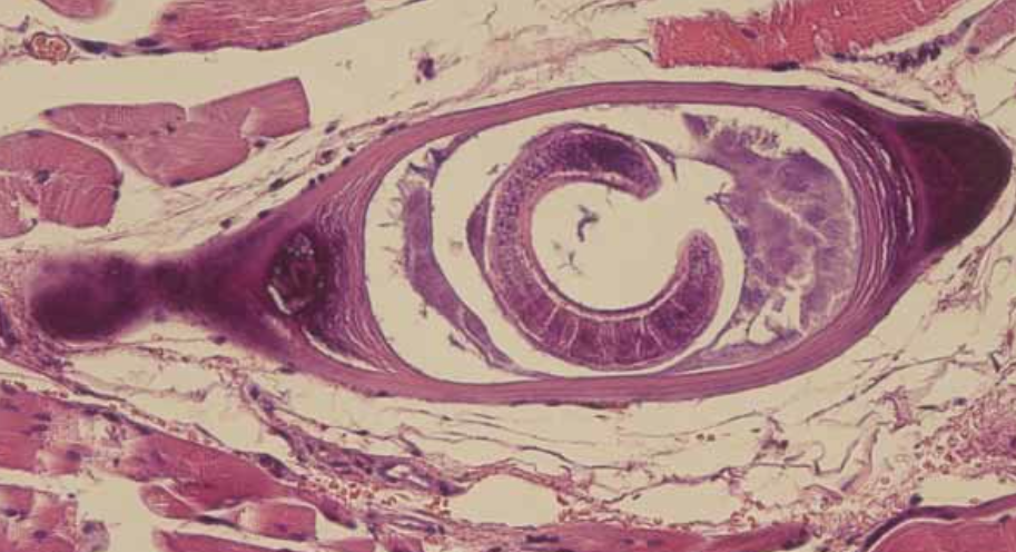 Профилактика трихинеллёза
