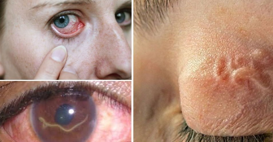 Профилактика дирофиляриоза