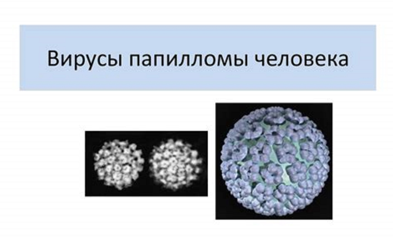 Что такое вирус папилломы человека (ВПЧ)?