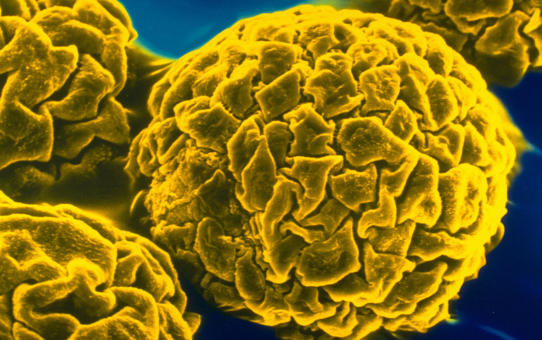 О профилактике желтой лихорадки